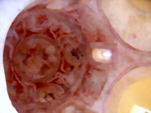 photo Visite commentée du Dompeter et chapelle Saint-Ulrich