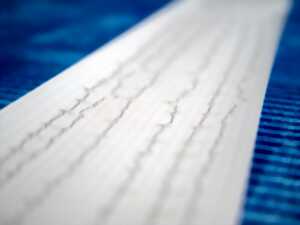 photo Journée de sensibilisation sur l'insuffisance cardiaque