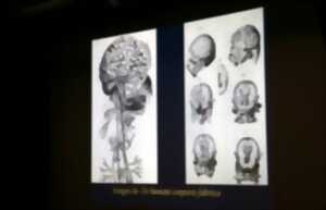 photo CONFERENCE « 1884-2026 : UN SIECLE ET DEMI D’HISTOIRE DE LA NEUROCHIRURGIE »